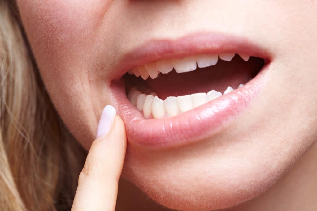 Tooth Sensitivity 1 in 8 Americans Have It Boulder