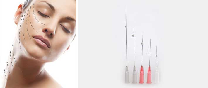 Thread Lift Treatment Dr Anil AntiAgeing Specialist. London Birmingham