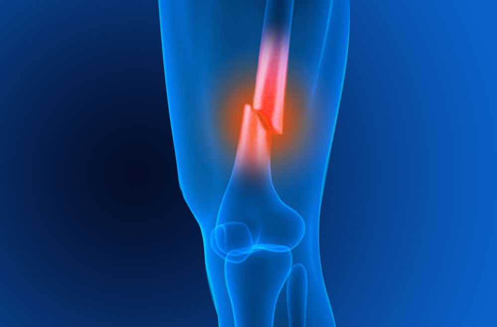 Knee ligament injury symptoms and recovery period Dr.Anjani Kumar