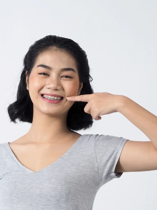 Best Orthodontic Treatment in Chennai 100 Expert Care