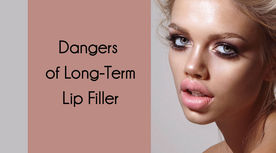 Dangers of LongTerm Lip Filler Dr. Anna Medical Aesthetics