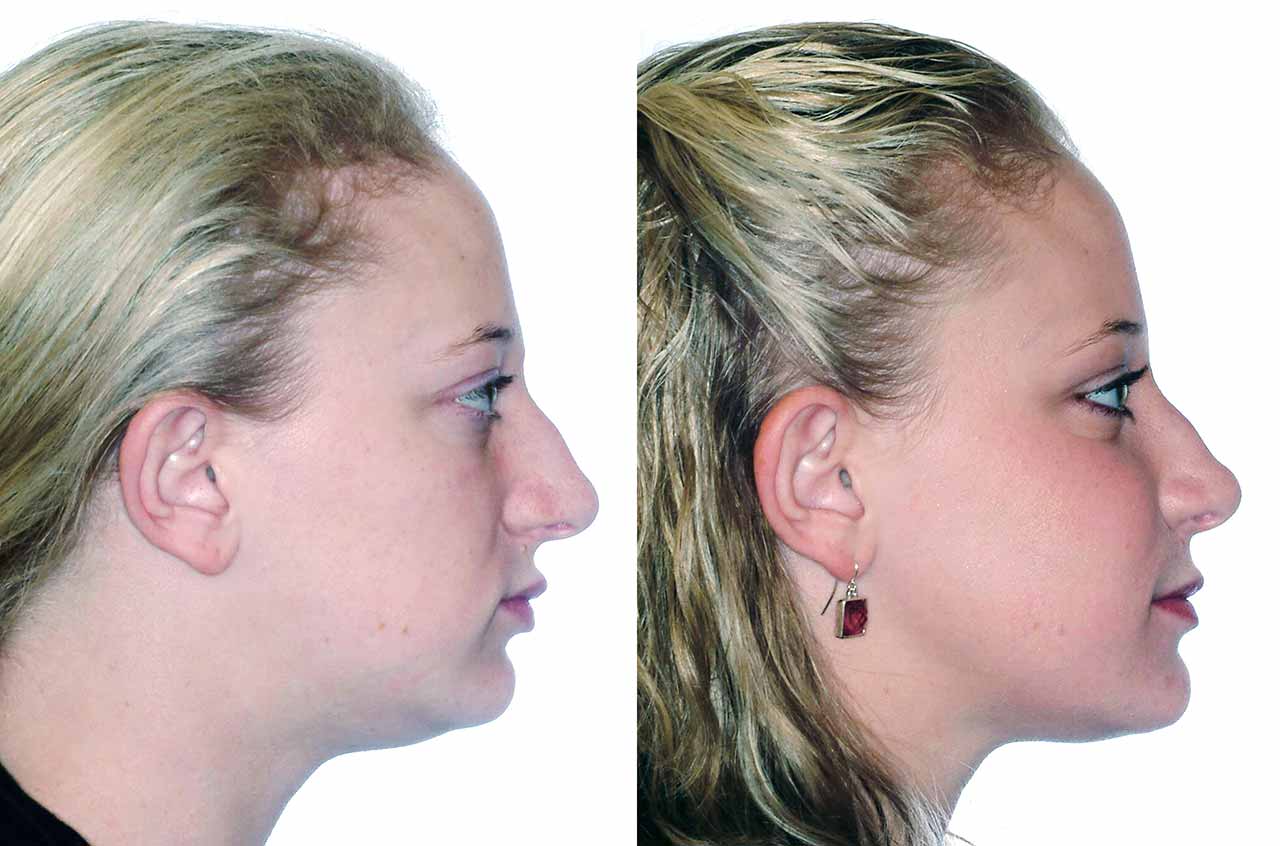 Face, Airway, and Bite Correction Surgery Solution Corrective Jaw
