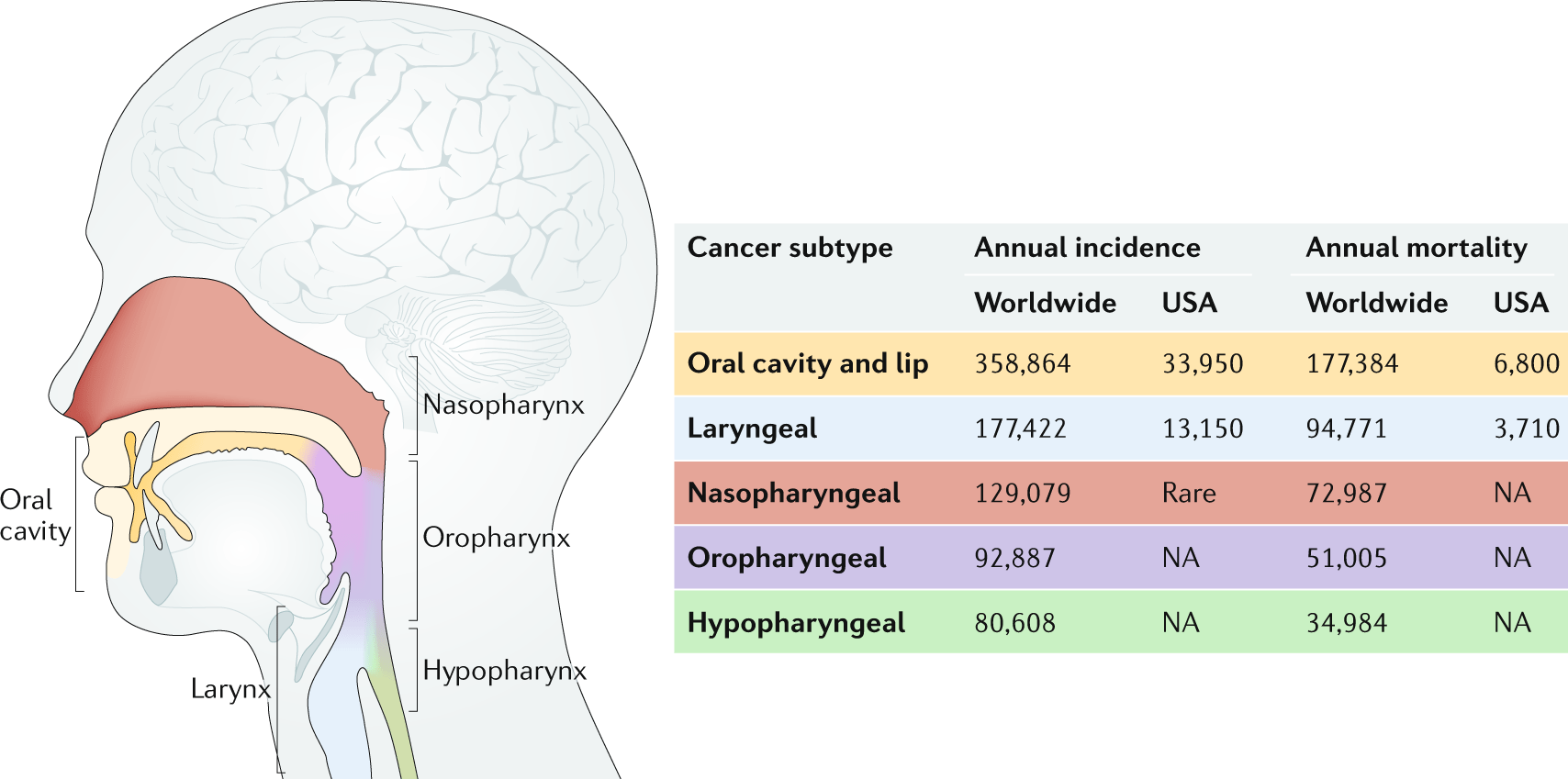 Head And Neck Cancer Diagram