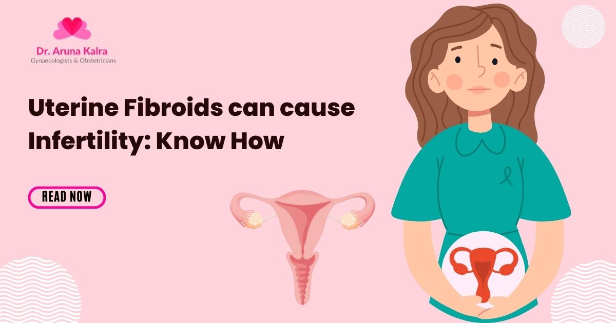 Uterine Fibroids Can Cause Infertility Know How Dr. Aruna Kalra Blog