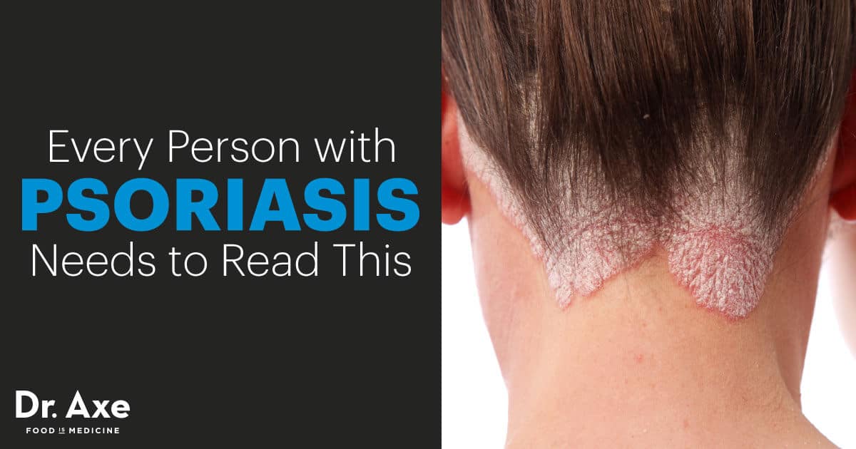 Psoriasis Diet and Natural Treatment Options Dr. Axe