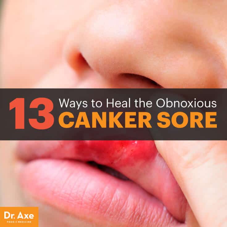 13 Ways to Heal the Canker Sore Dr. Axe