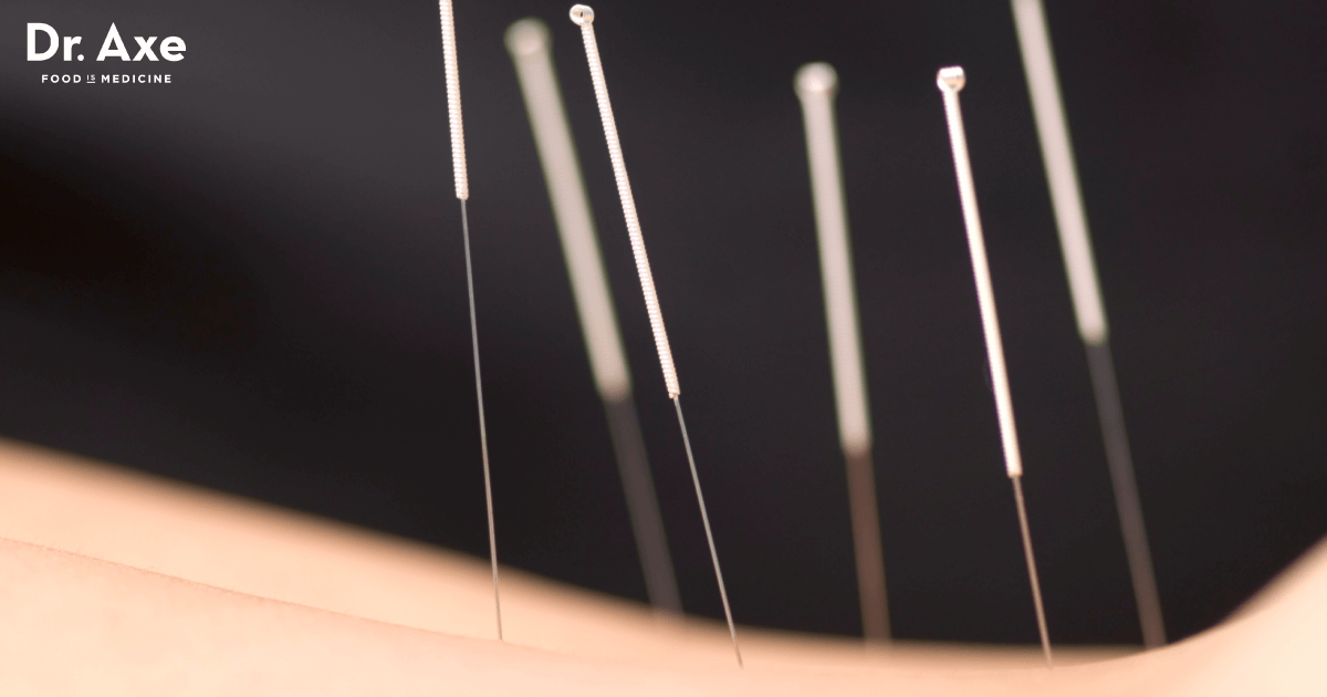 Dry Needling for Muscle Pain Relief & More Dr. Axe