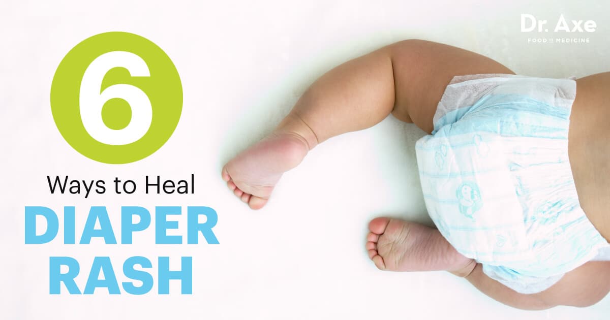 Diaper Rash Treatments, Causes & Symptoms Dr. Axe