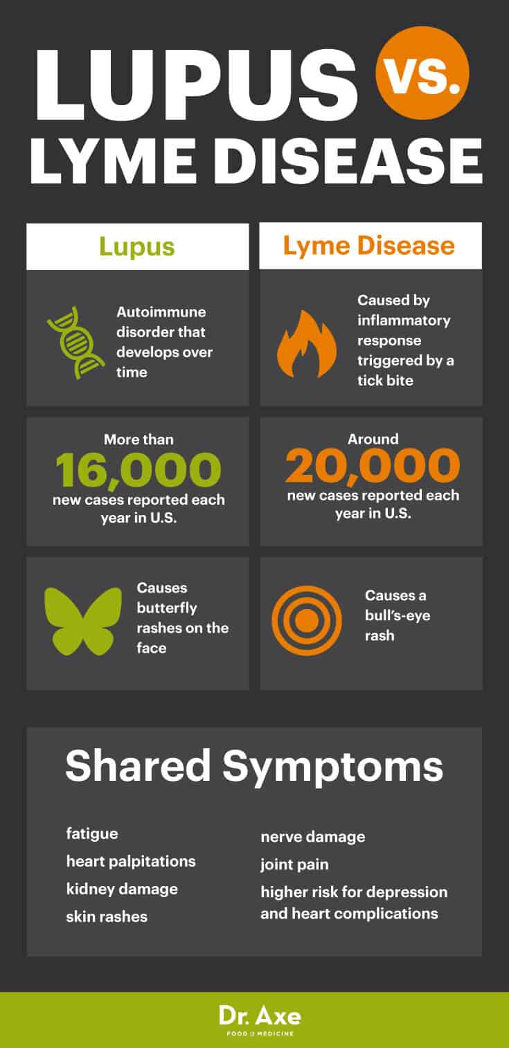 Lupus Symptoms + 6 Natural Ways to Manage It Dr. Axe