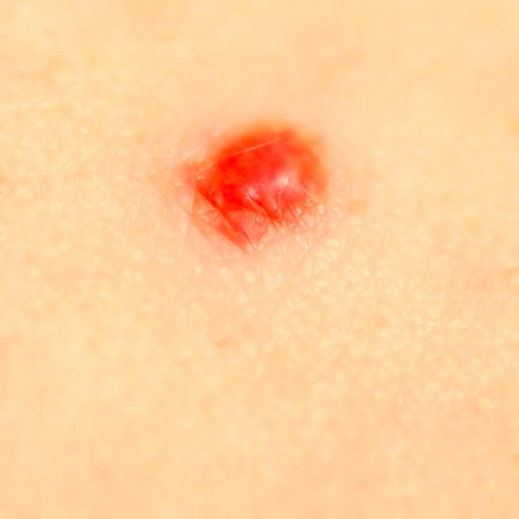 Recolectar 88+ images bright red mole Viaterra.mx