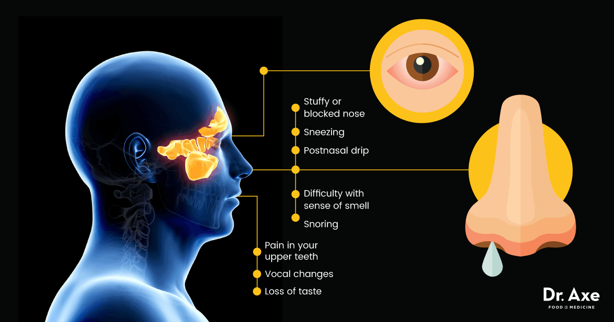 Nasal Polyps 19 Natural Treatments + Lifestyle Changes