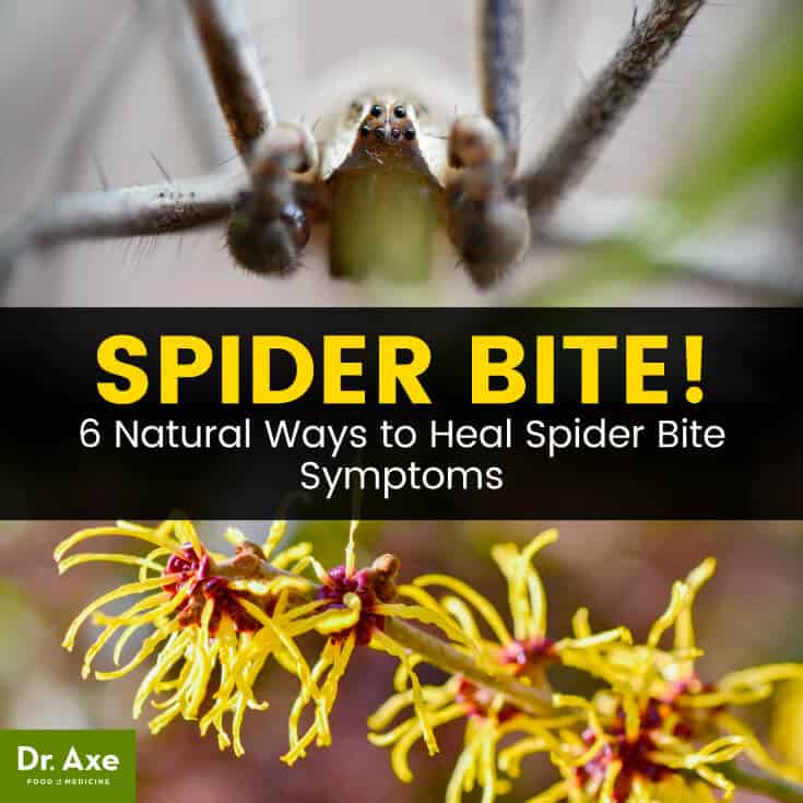 Spider Bite Symptoms + 6 Easy Natural Treatments Best Pure Essential Oils
