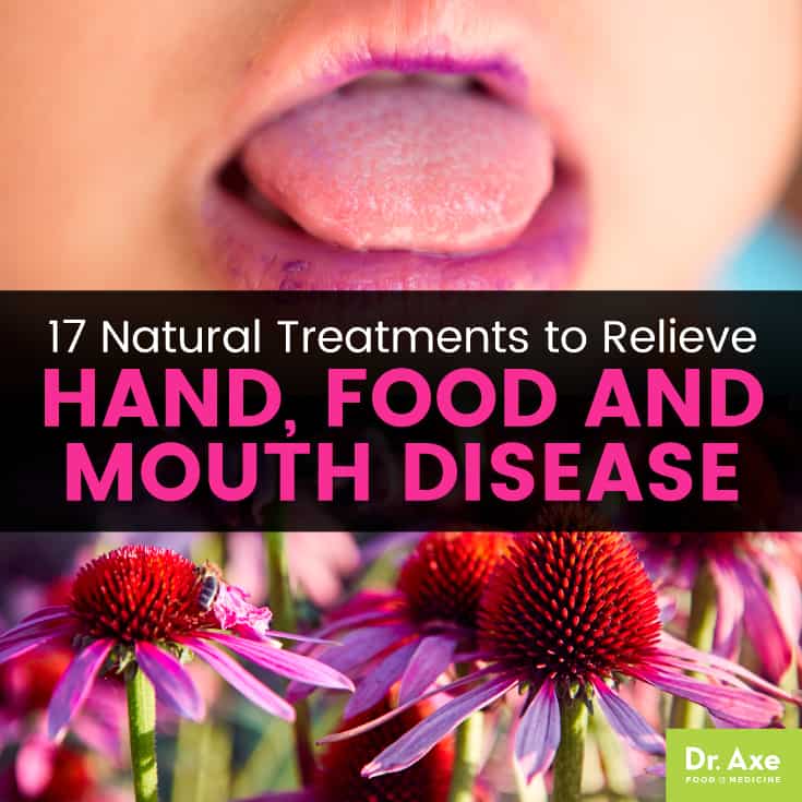 Hand Foot Mouth Disease Treatment Diet rutrackerhospital