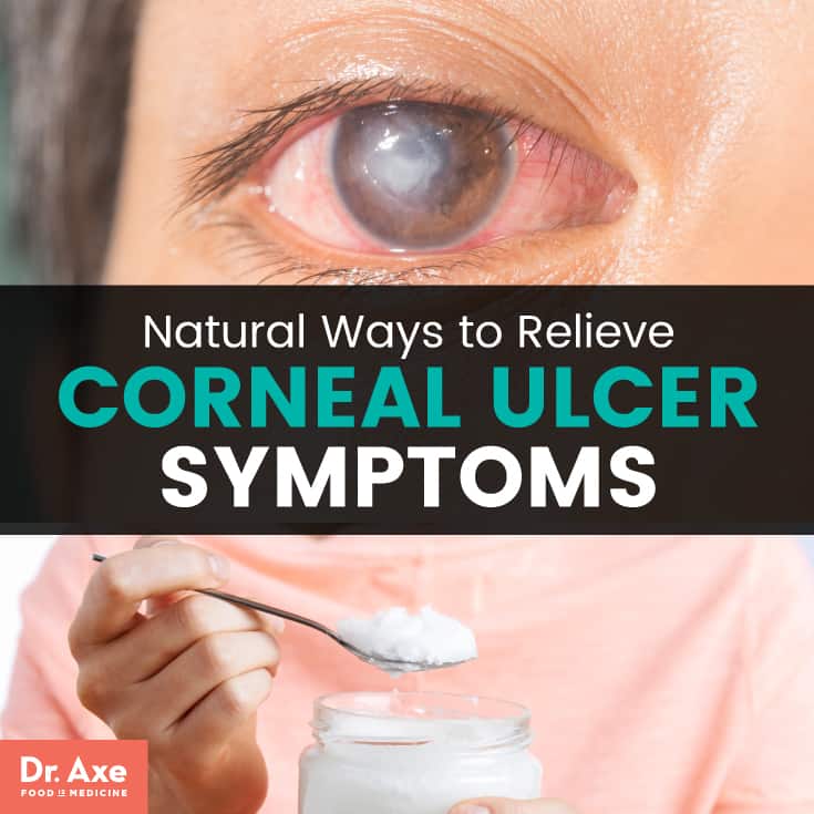 Corneal Ulcer Symptoms + Relieve Symptoms 11 Natural Ways Dr. Axe