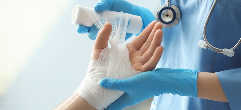 How to Treat a Burn at Home (Naturally!) Dr. Axe