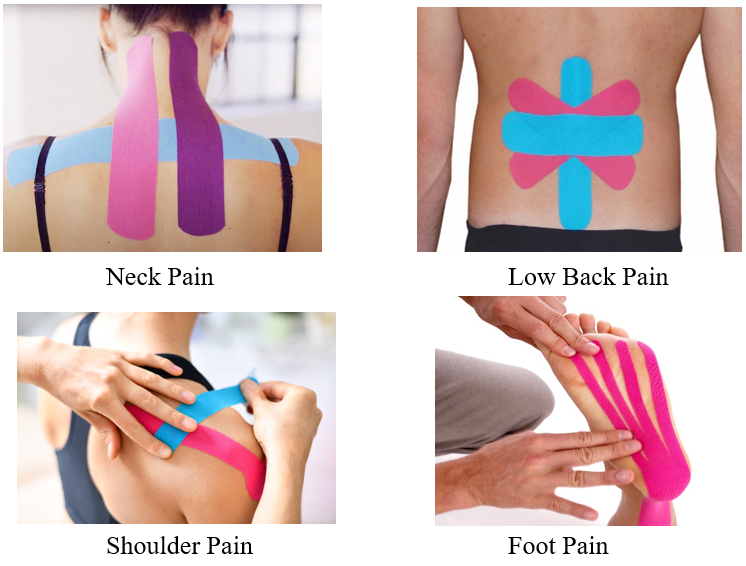 Kinesiology Tape (KT Taping) Chiropractors in Woodbridge, VA Prince