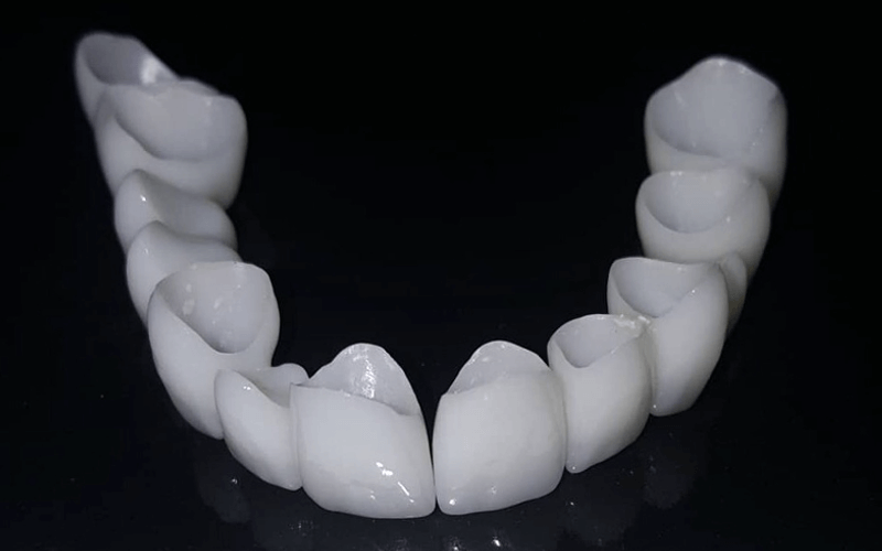 DENTAL PROSTHETICS Dental Office Dr Rosa Bašić