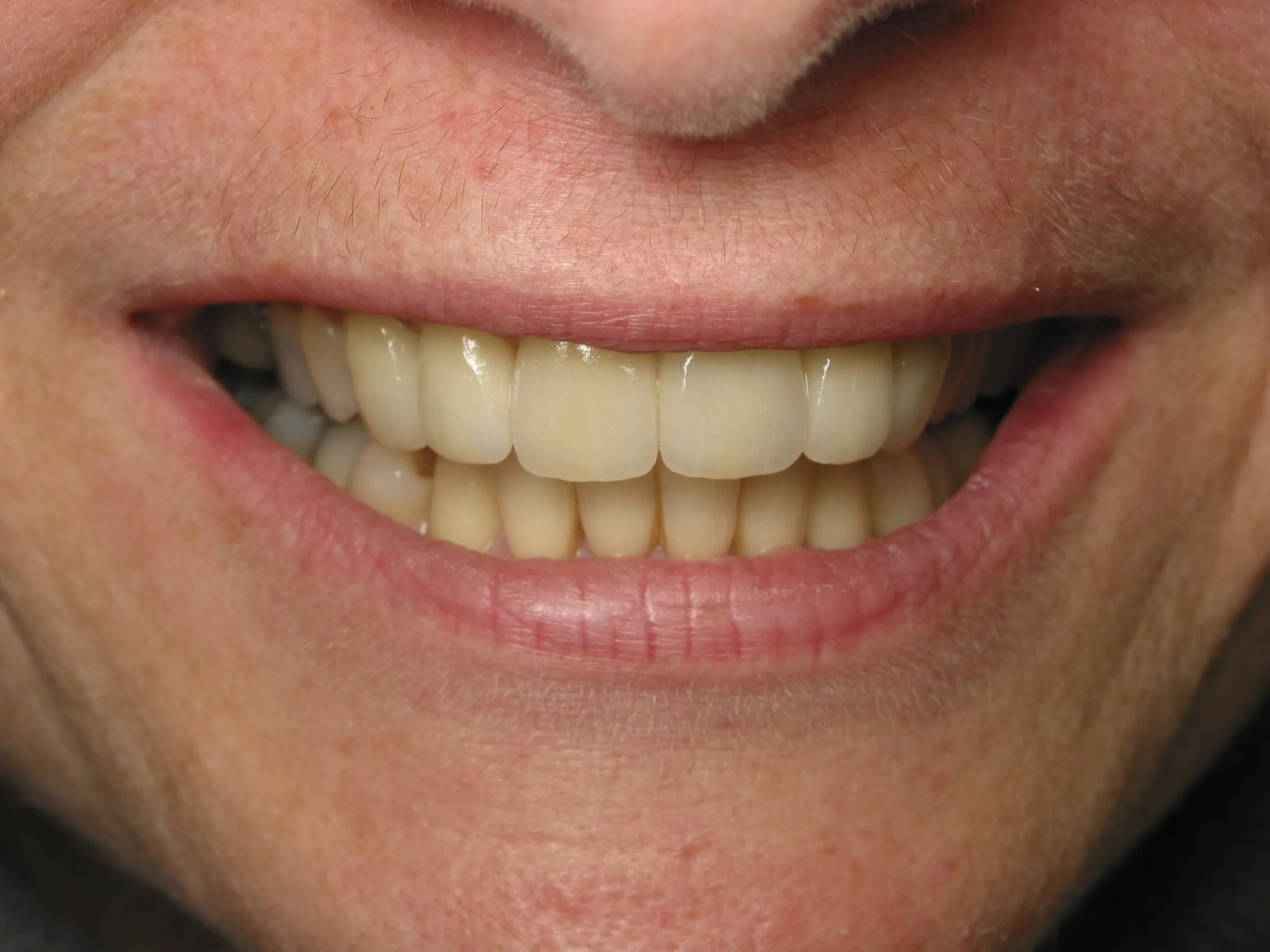 Don't the Lips! Dr. Beatrice Leung