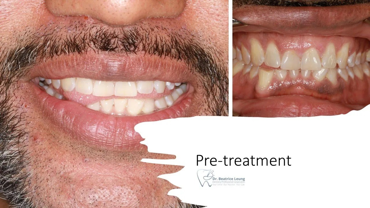 How I go from here to there... Dr. Beatrice Leung