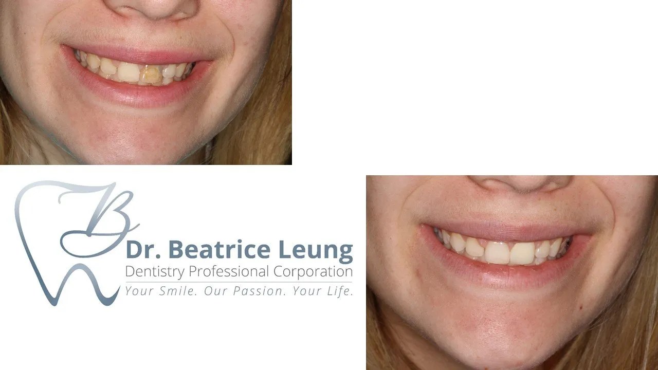 The Power of A Smile Dr. Beatrice Leung