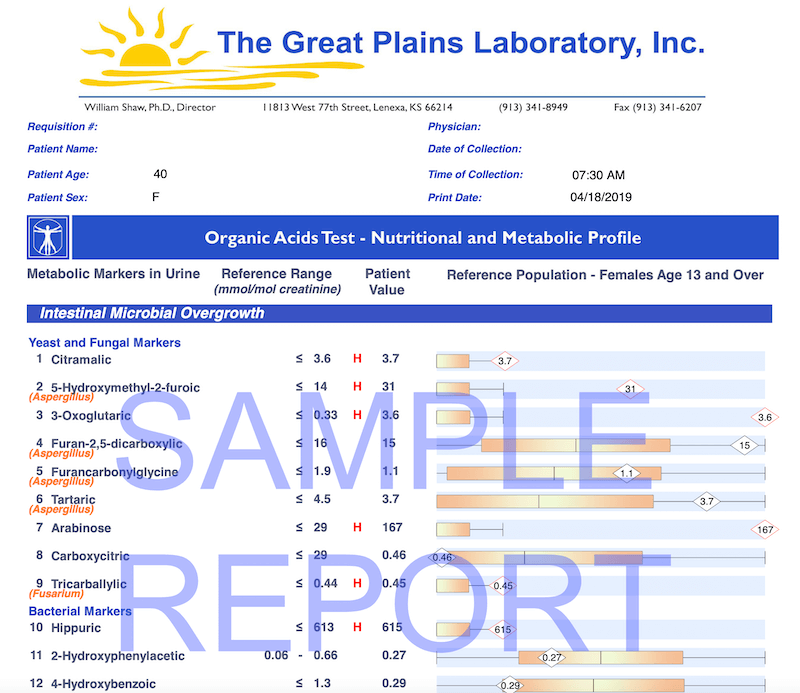 What Is An OAT Test and How Can It Help Me?