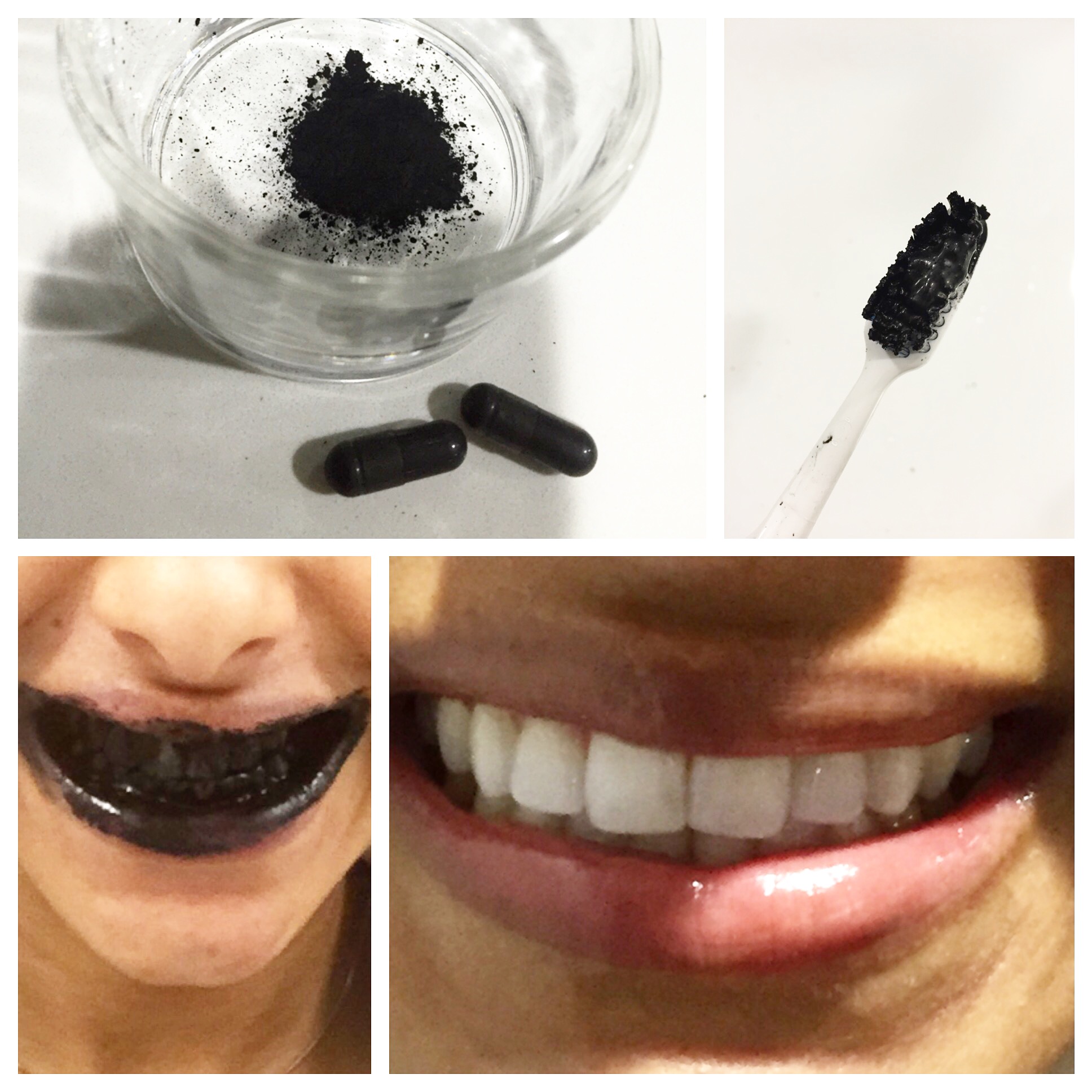 5 ways to whiten your teeth naturally! Dr. Bindiya