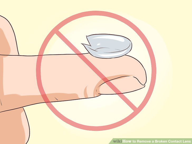 CAUTIONS AND CONTRAINDICATIONS OF USING RGP LENS (Include OKLens