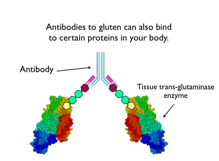 What is celiac disease? A recipe for recovery beyond gluten free