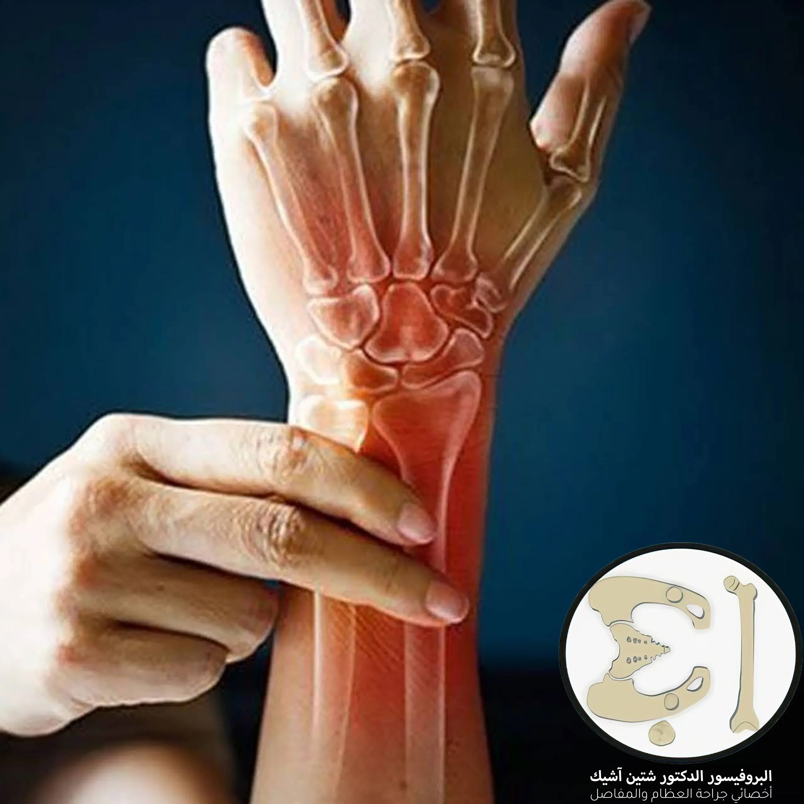 Causes and treatment of joint stiffness Dr. What's wrong with you?