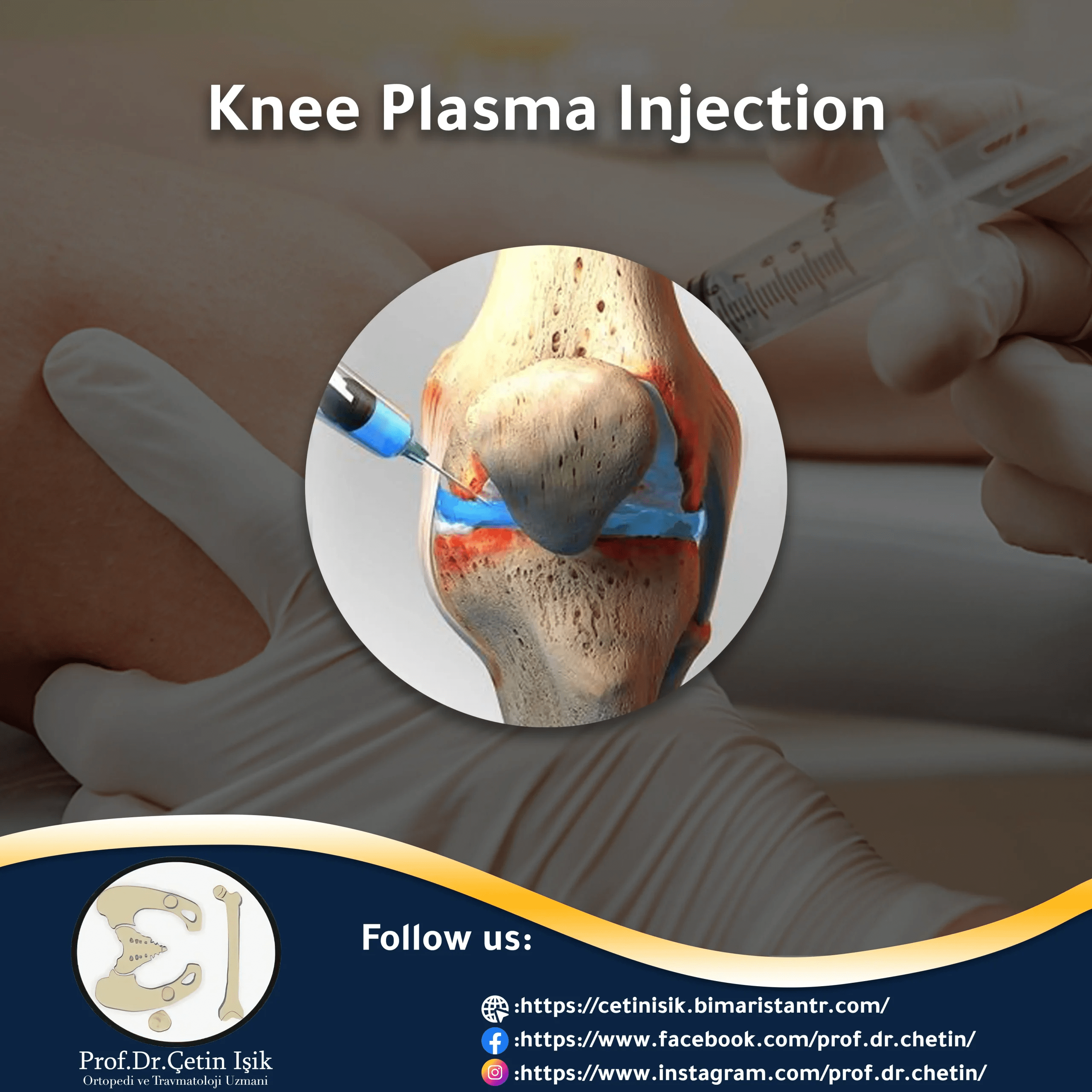 Plasma injection for the knee Dr. What's wrong with you?