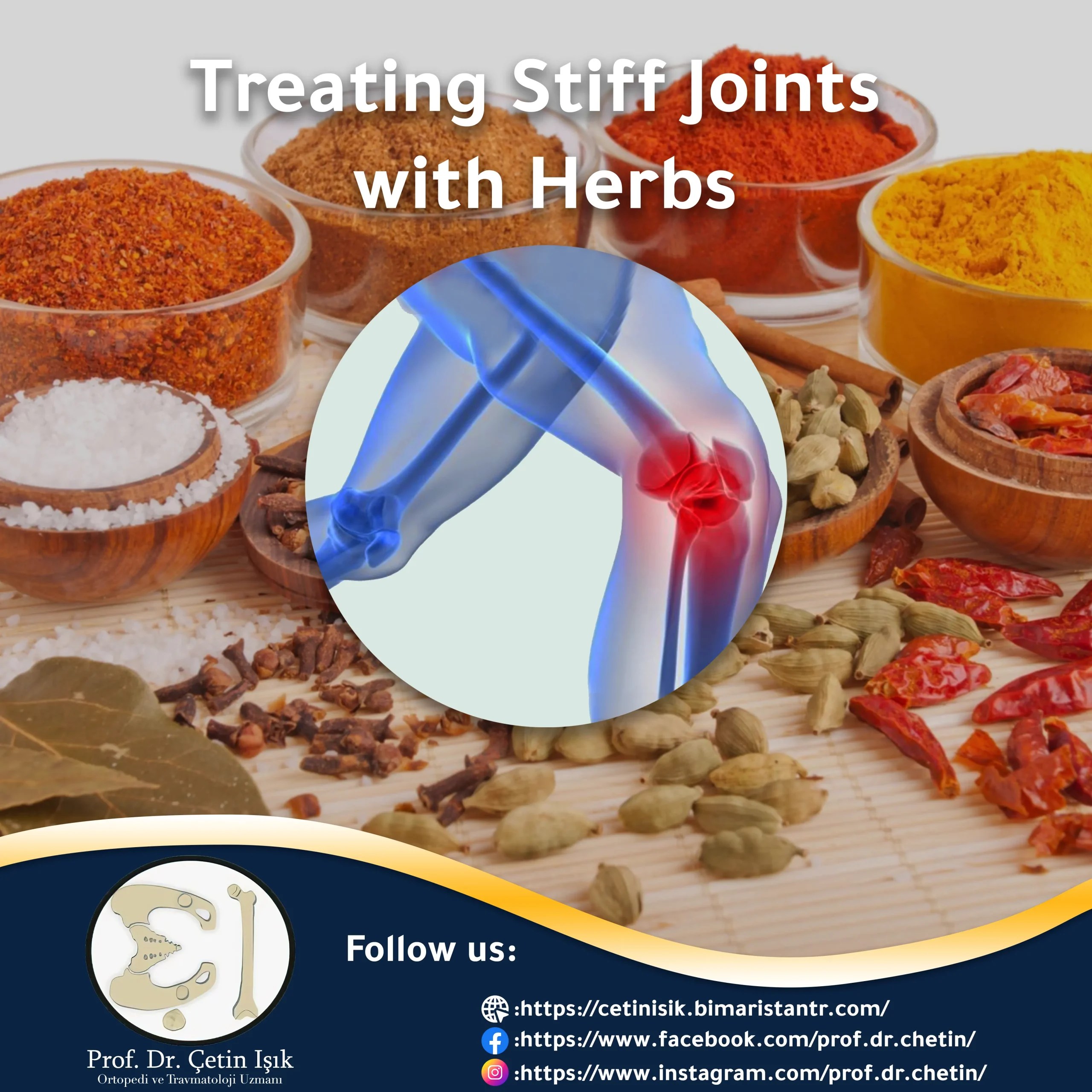 The 9 best plants to treat joint stiffness with herbs Dr. What's