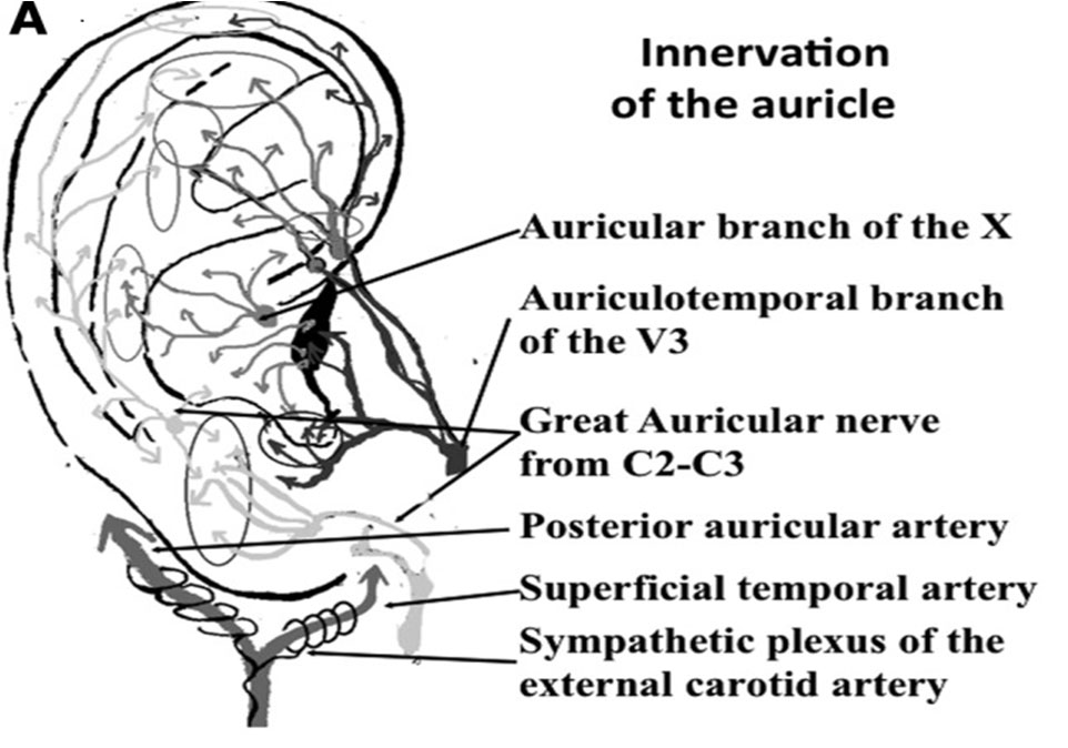 Battlefield Acupuncture Rapid Auriculotherapy Technique For Pain Reduction