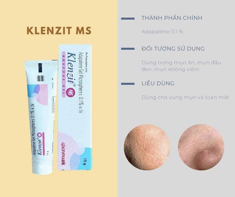 Klenzit Ms mua ở đâu, Giá bao nhiêu Klenzit Ms và Klenzit C Dr.Da