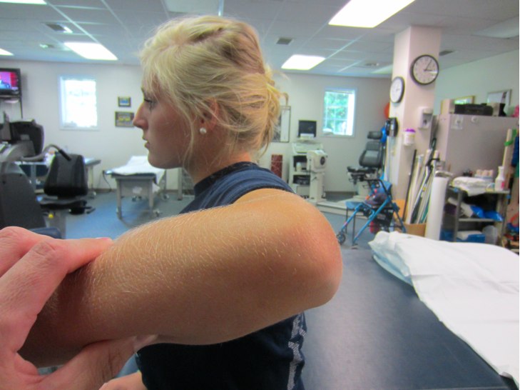 50kshoulder injury Internal Impingement of the Shoulder Sports