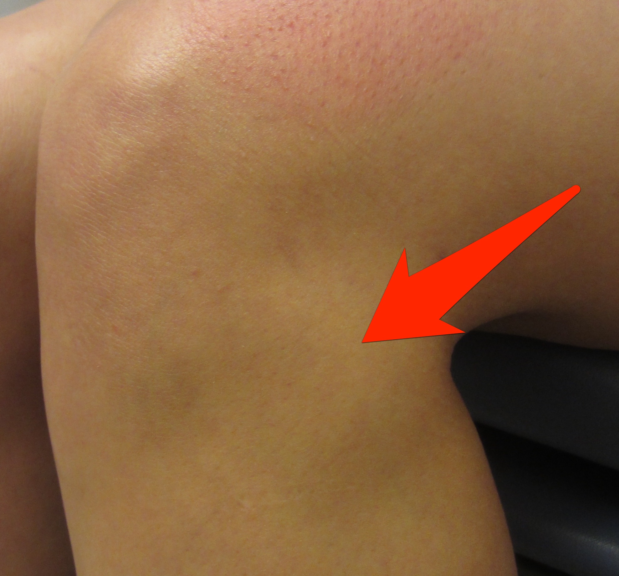 Marcus Lattimore Initial thoughts on gruesome knee injury Dr Geier