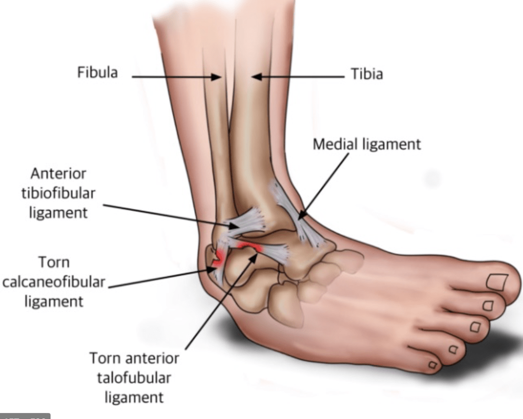 Lateral Ligament Instability David Shepherd