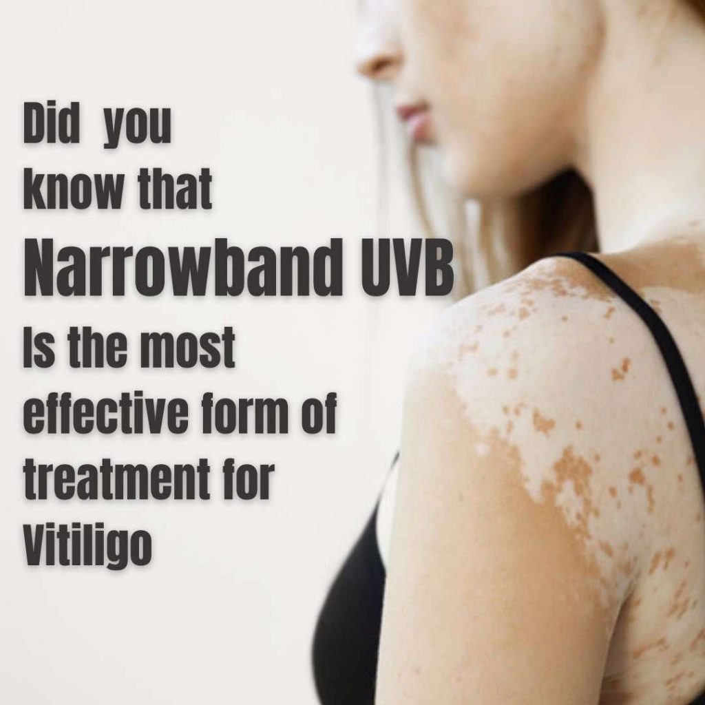 Vitiligo Genital Areas Dr Davin Lim