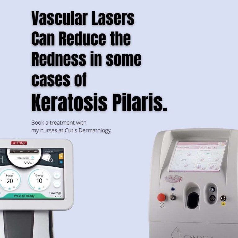 Best Keratosis Pilaris Treatment In Australia Dr Davin Lim