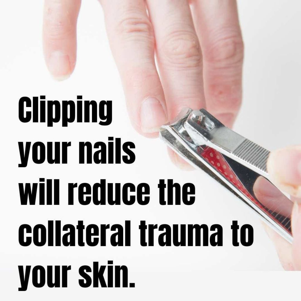 Skin Picking Disorder Wound Care Dr Davin Lim