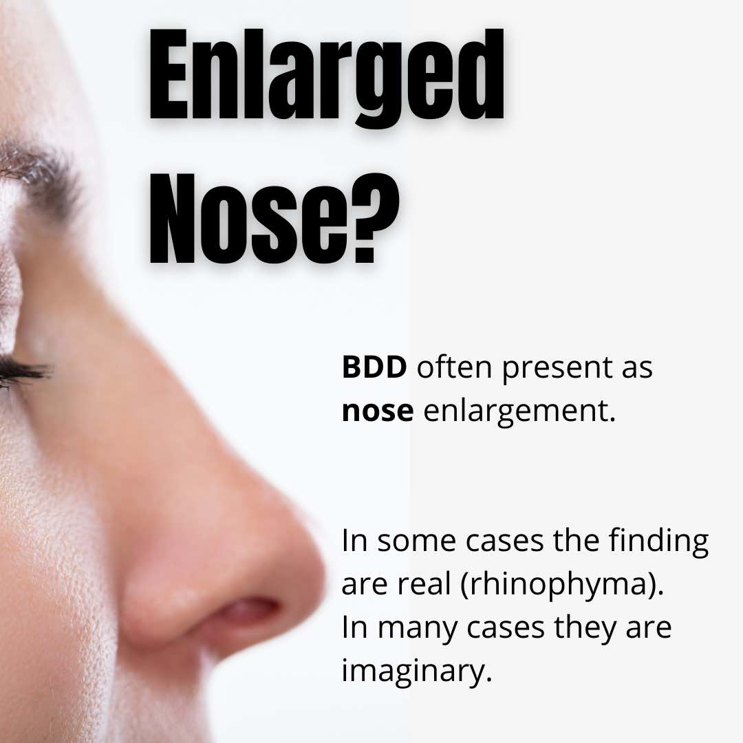 Body Dysmorphic Disorder Dr Davin Lim