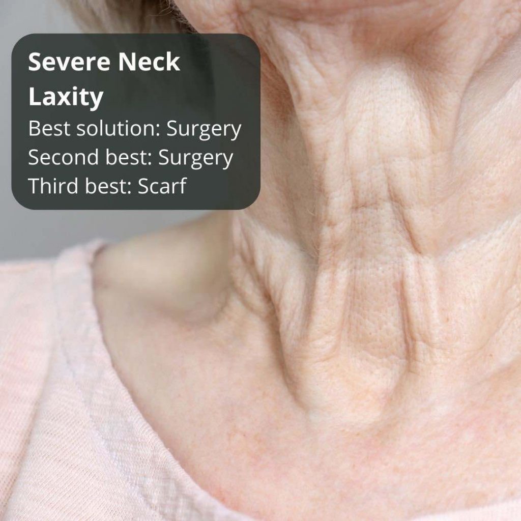 Neck And Chest Rejuvenation Gallery Dr Davin Lim