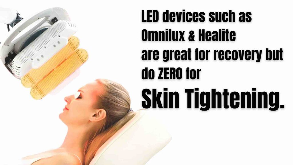 Neck And Chest Rejuvenation Gallery Dr Davin Lim