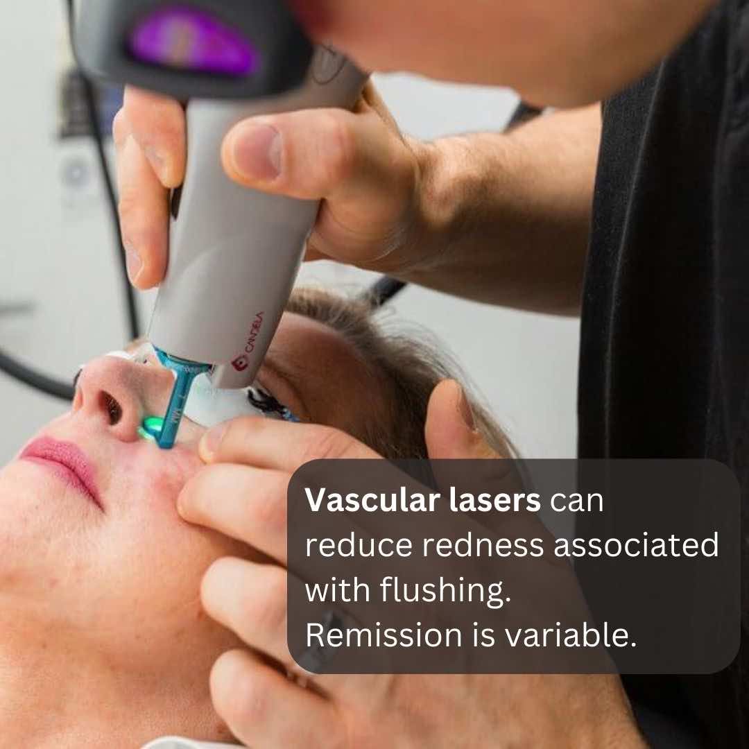 Flushing Treatments Dr Davin Lim