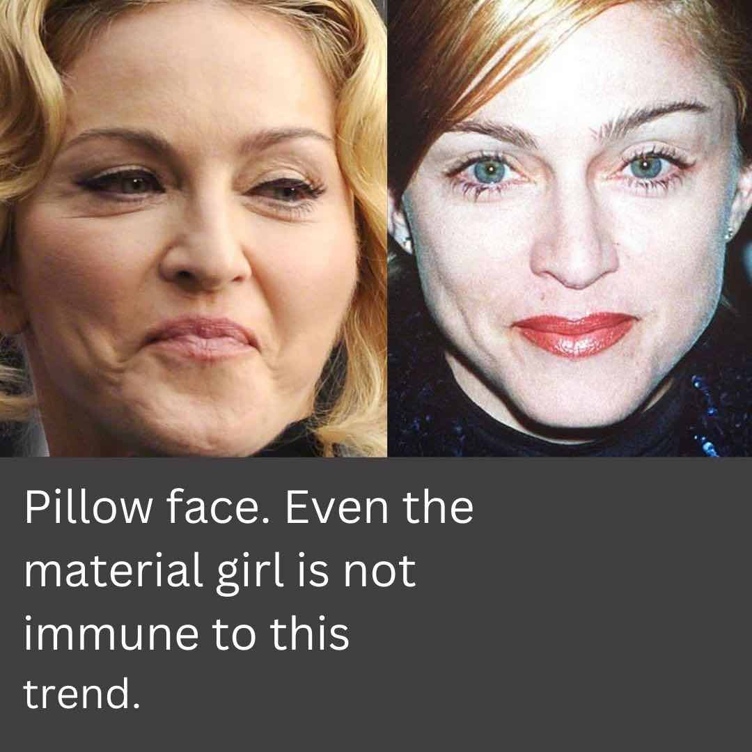 Dermal Fillers, Side Effects Dr Davin Lim