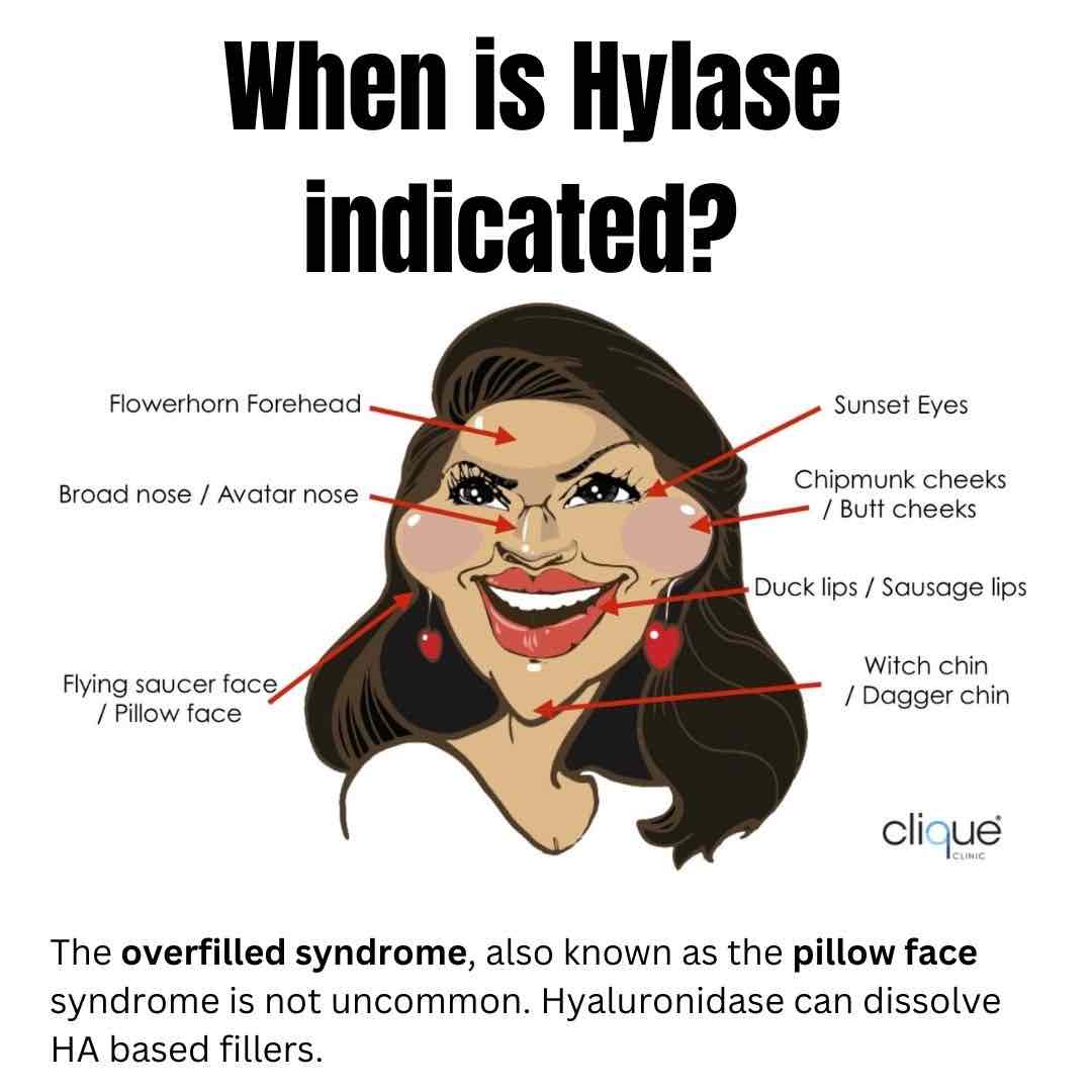 Dermal Fillers, Side Effects Dr Davin Lim