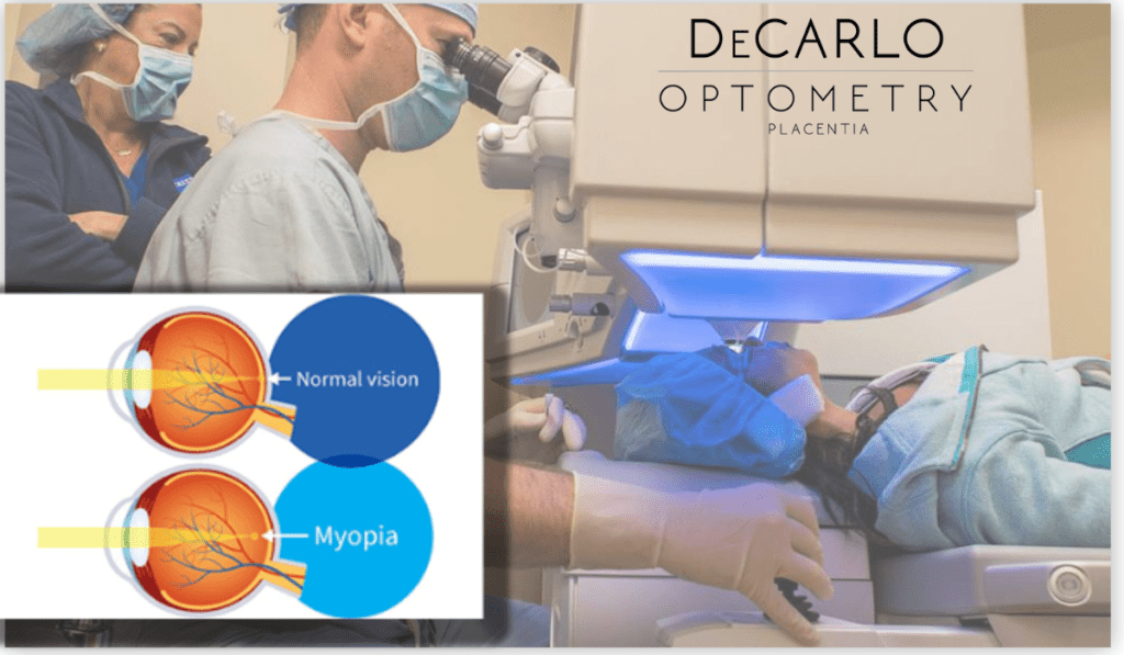 Mastering Myopia Orthok's Role in Vision Correction