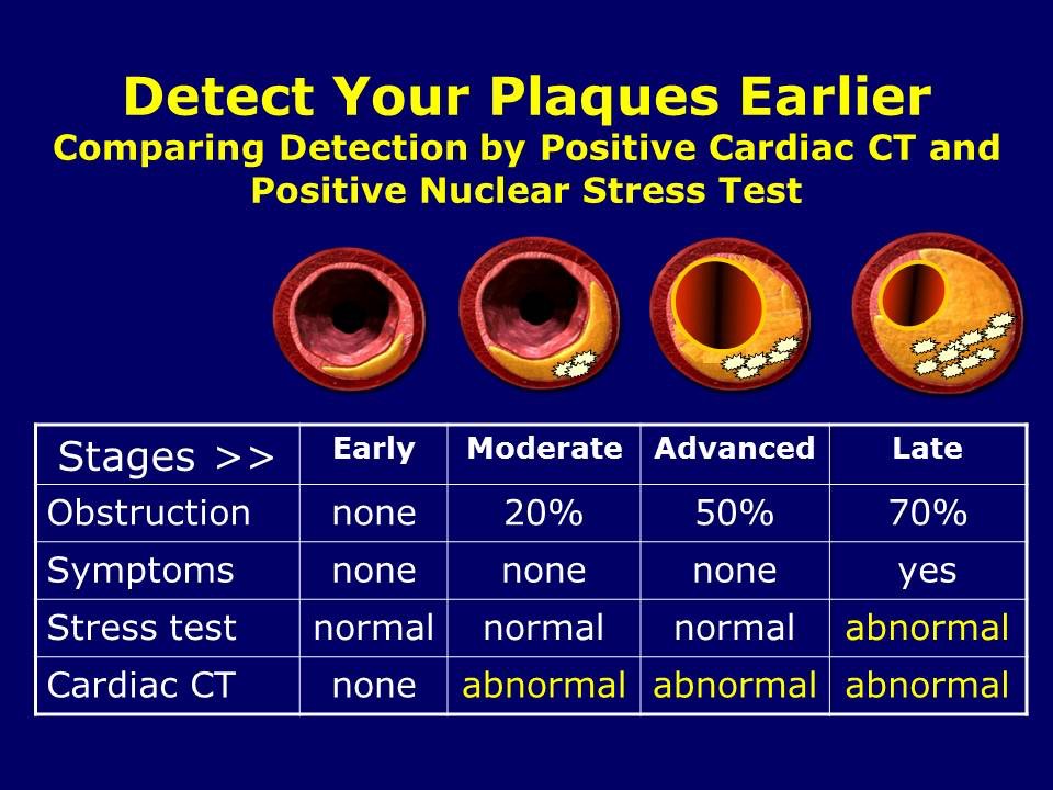 Coronary Calcium Scan Rolando L. deGoma, MD, FACC, FNLA Rolando L