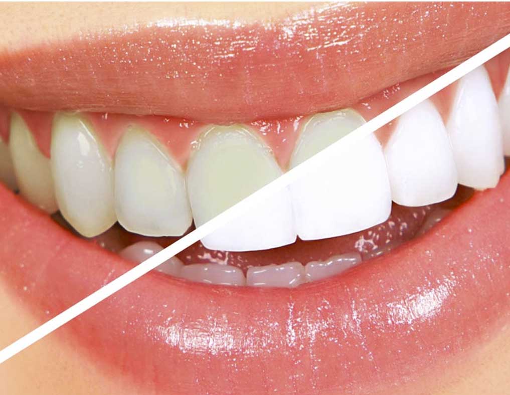 Dental FAQs Dental Image McAllen Dentist