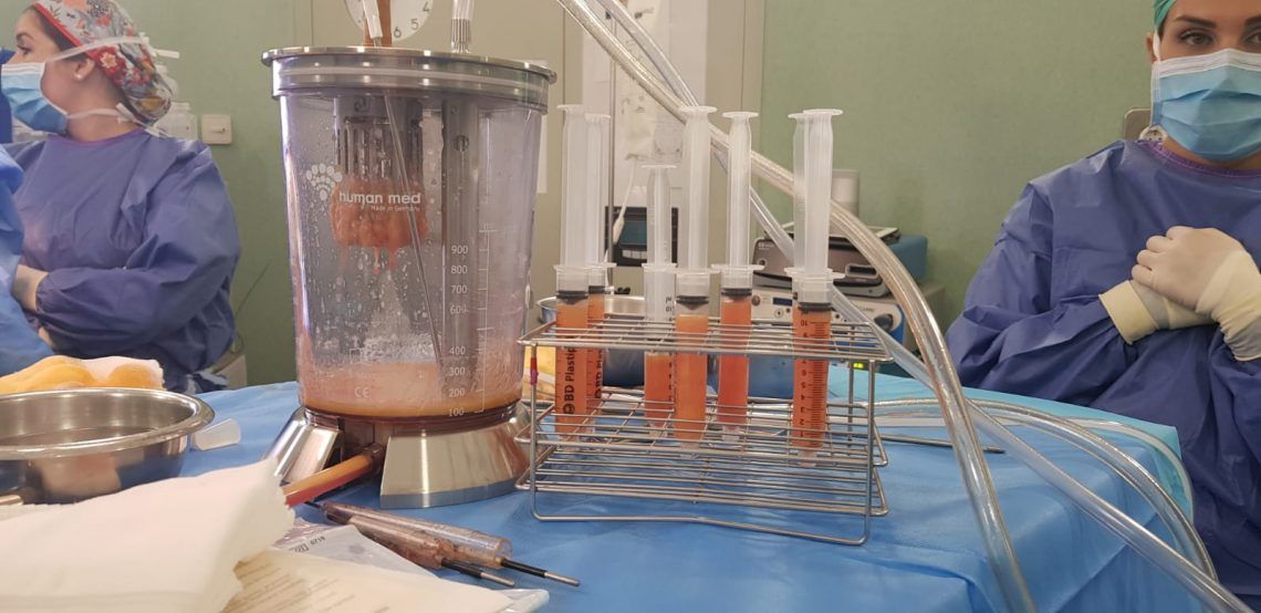 BodyJet Lipo, una revolución en las técnicas de liposucción