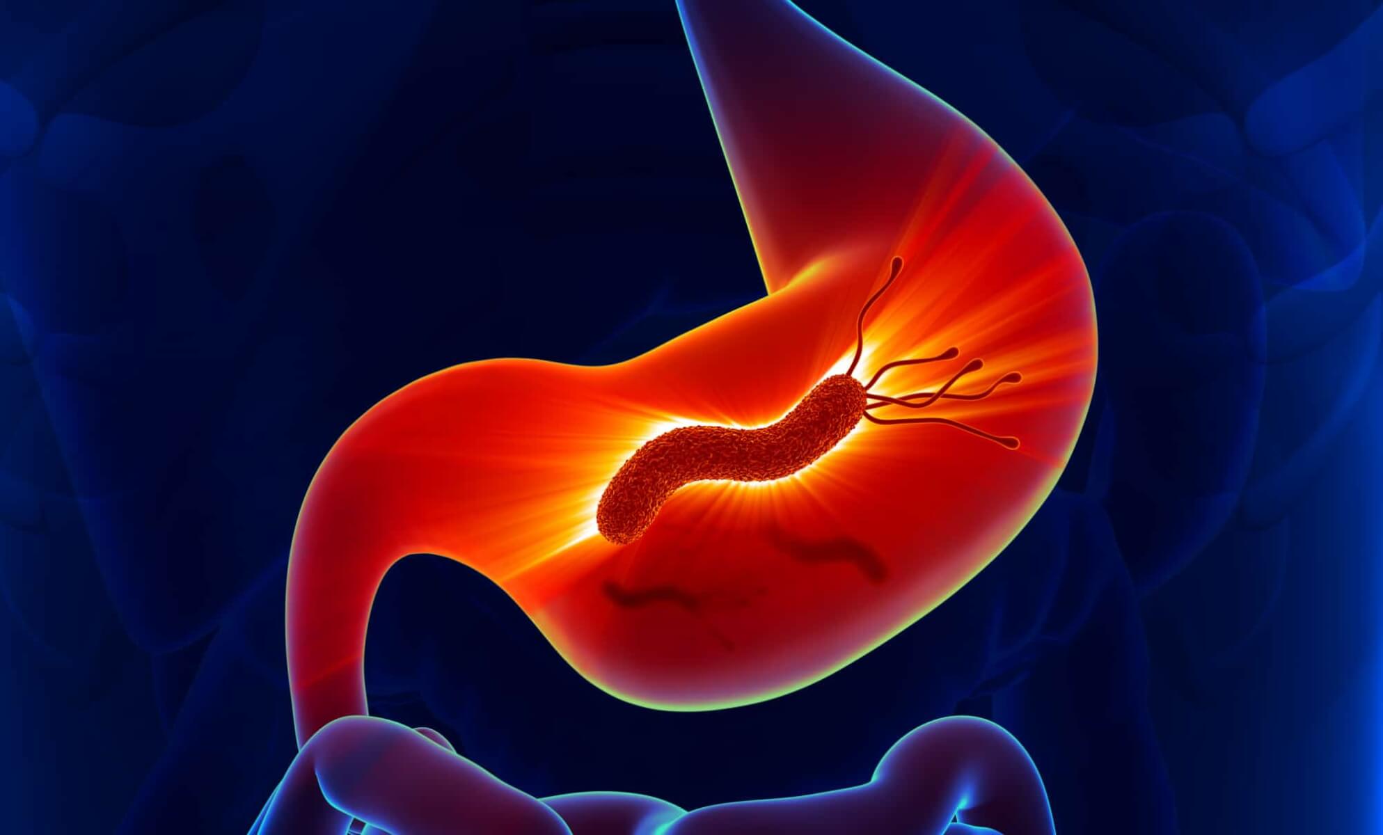 H. pylori saiba o que é, conheça os sintomas e o tratamento Diego